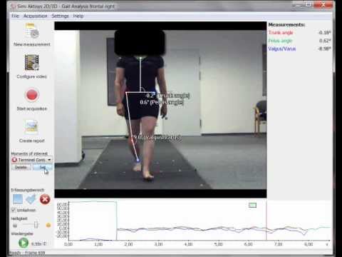 Система видео анализа ходьбы