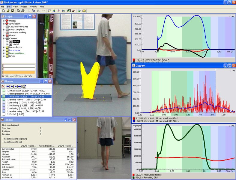 Системы видео анализа ходьбы